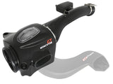 Advanced FLOW Engineering Momentum GT Cold Air Intake System w/Pro DRY S Media 51-76011